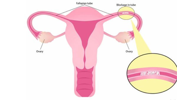 Important Role of Fallopian Tube during Pregnancy