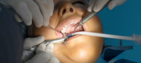 Dentist for Zygomatic Implants